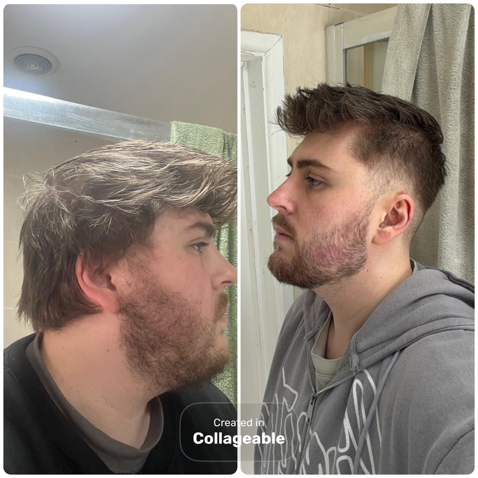 Antes y Después 2